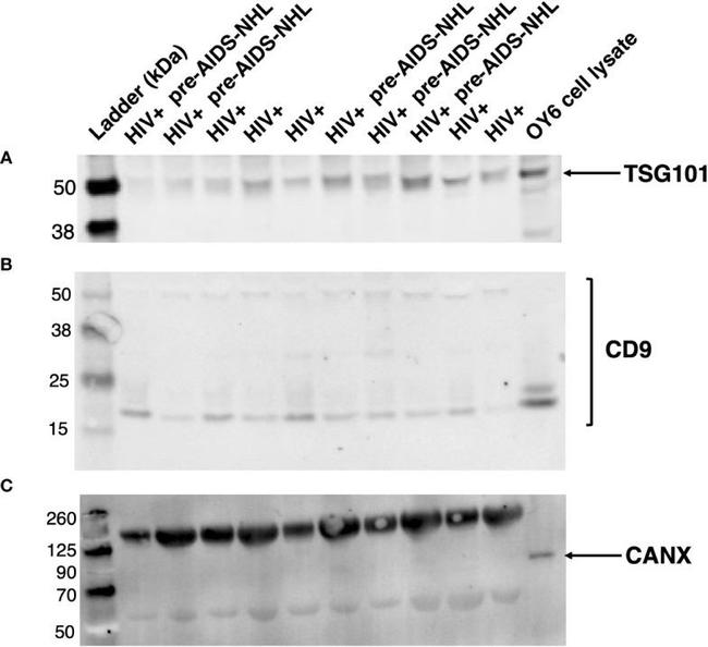 Calnexin Antibody in Western Blot (WB)