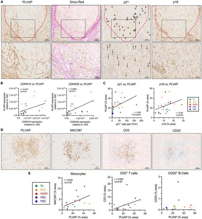 Calprotectin Antibody in Immunohistochemistry (IHC)