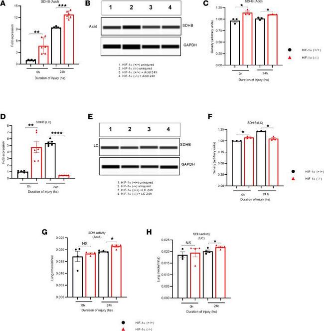 SDHB Antibody in Western Blot (WB)