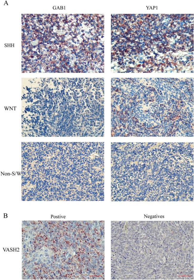 VASH2 Antibody in Immunohistochemistry (Paraffin) (IHC (P))