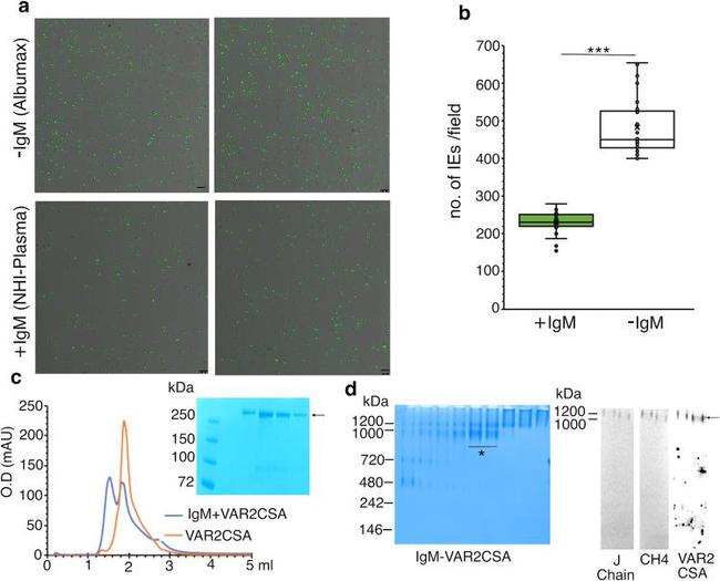 J Chain Antibody in Western Blot (WB)