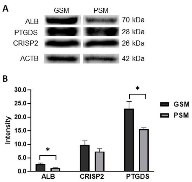 Albumin Antibody in Western Blot (WB)