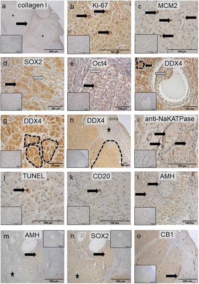 SOX2 Antibody in Immunohistochemistry (Paraffin) (IHC (P))