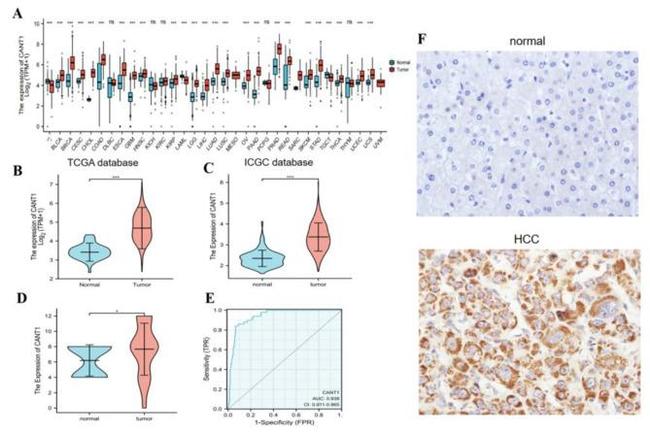 CANT1 Antibody in Immunohistochemistry (Paraffin) (IHC (P))