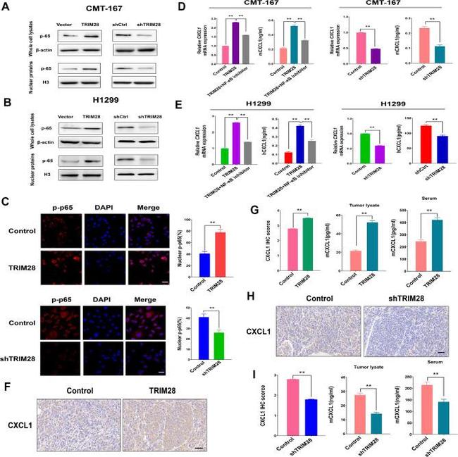 CXCL1 Antibody in Immunohistochemistry (IHC)