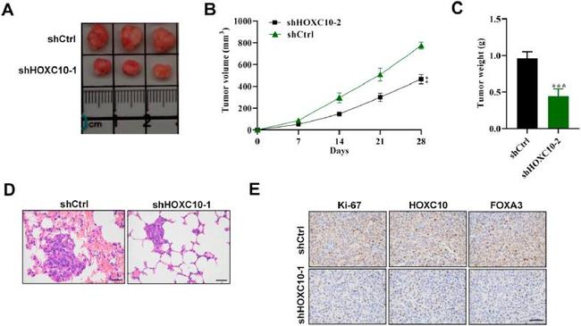 FOXA3 Antibody in Immunohistochemistry (Paraffin) (IHC (P))