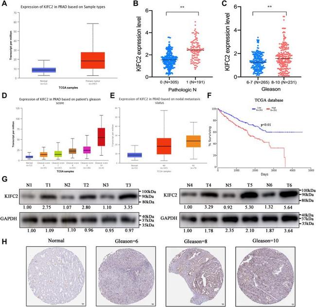 KIFC2 Antibody in Immunohistochemistry (Paraffin) (IHC (P))