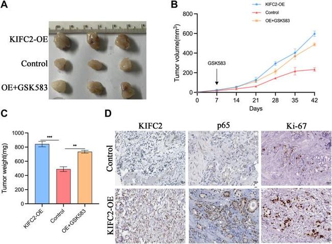 KIFC2 Antibody in Immunohistochemistry (Paraffin) (IHC (P))