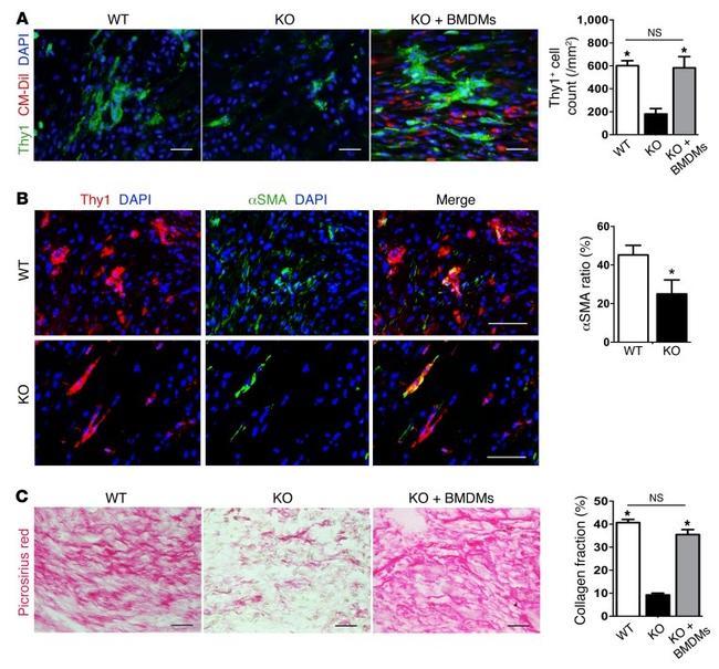 CD90 (Thy-1) Antibody in Immunohistochemistry (IHC)