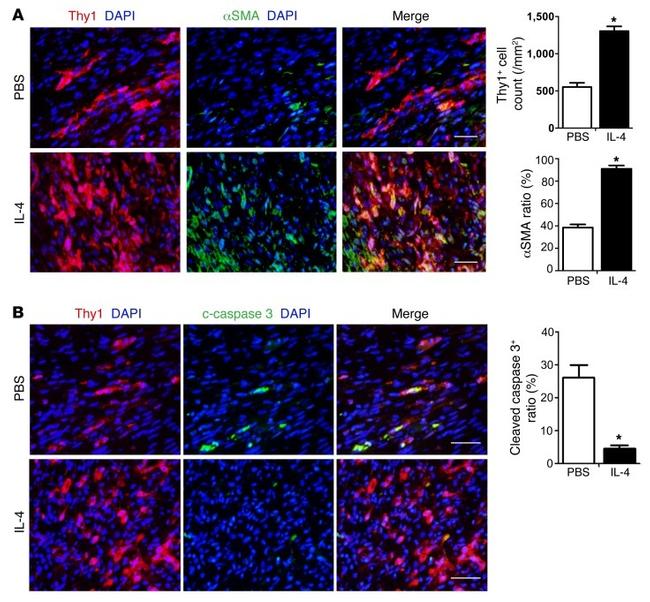 CD90 (Thy-1) Antibody in Immunohistochemistry (IHC)