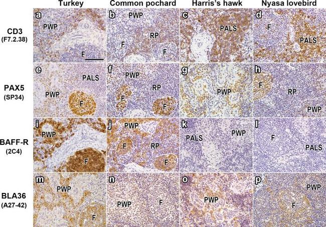 CD20 Antibody in Immunohistochemistry (IHC)