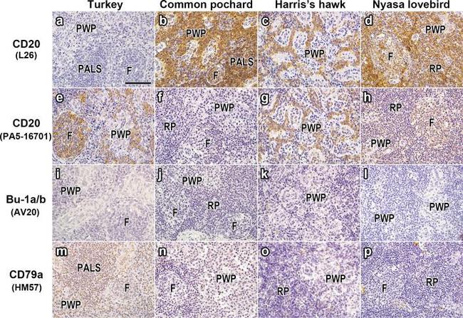 CD20 Antibody in Immunohistochemistry (Paraffin) (IHC (P))