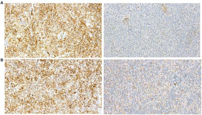 GluR2 Antibody in Immunohistochemistry (IHC)