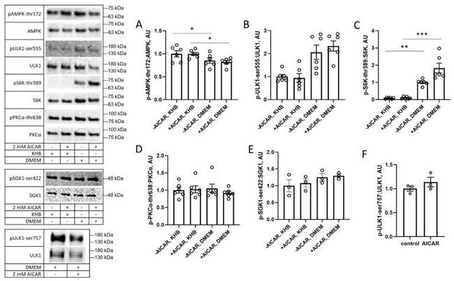 SGK1 Antibody in Western Blot (WB)