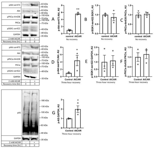 SGK1 Antibody in Western Blot (WB)