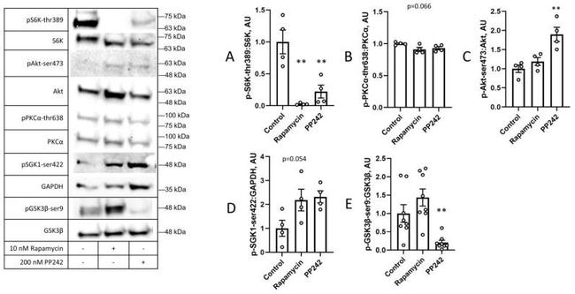 SGK1 Antibody in Western Blot (WB)