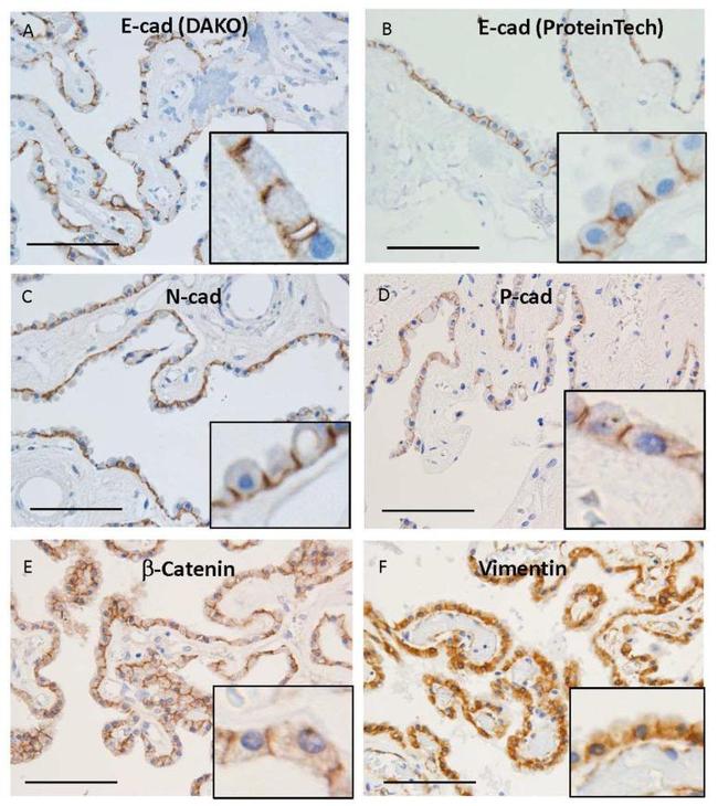 P-cadherin Antibody in Immunohistochemistry (IHC)