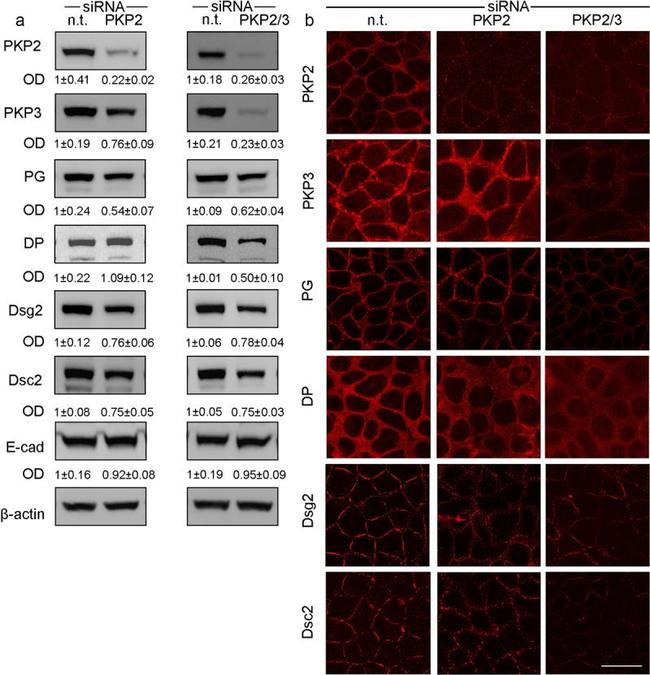 Desmocollin 2/3 Antibody in Western Blot (WB)