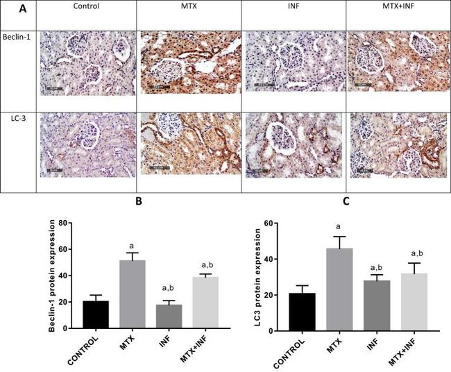 LC3A/LC3B Antibody in Immunohistochemistry (Paraffin) (IHC (P))