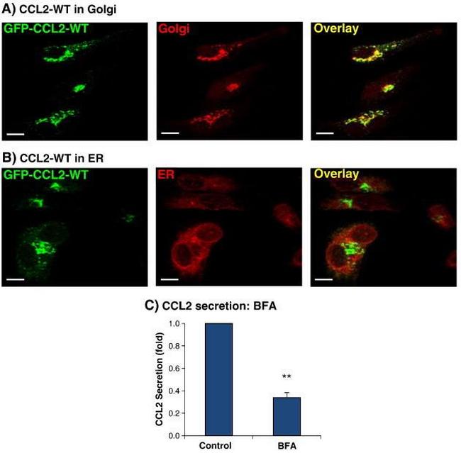 MCP-1 Antibody in Western Blot (WB)