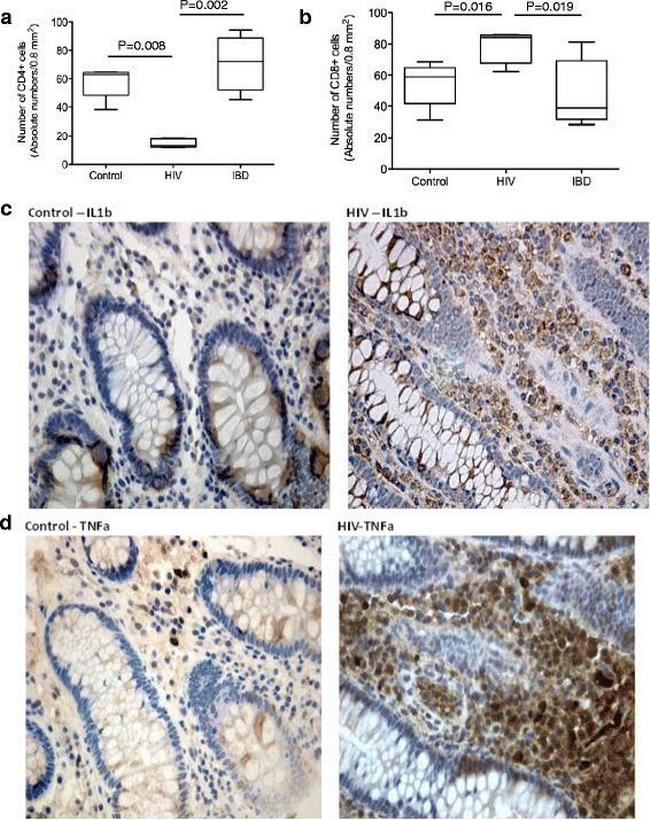 TNF alpha Antibody in Immunohistochemistry (IHC)