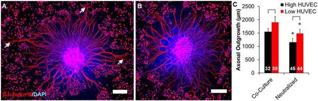 BDNF Antibody in Neutralization (Neu)