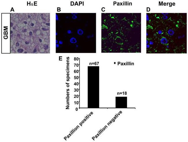 Paxillin Antibody in Immunocytochemistry (ICC/IF)