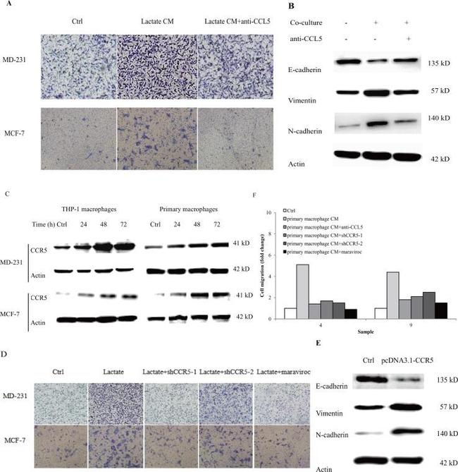 CCL5 (RANTES) Antibody in Neutralization (Neu)