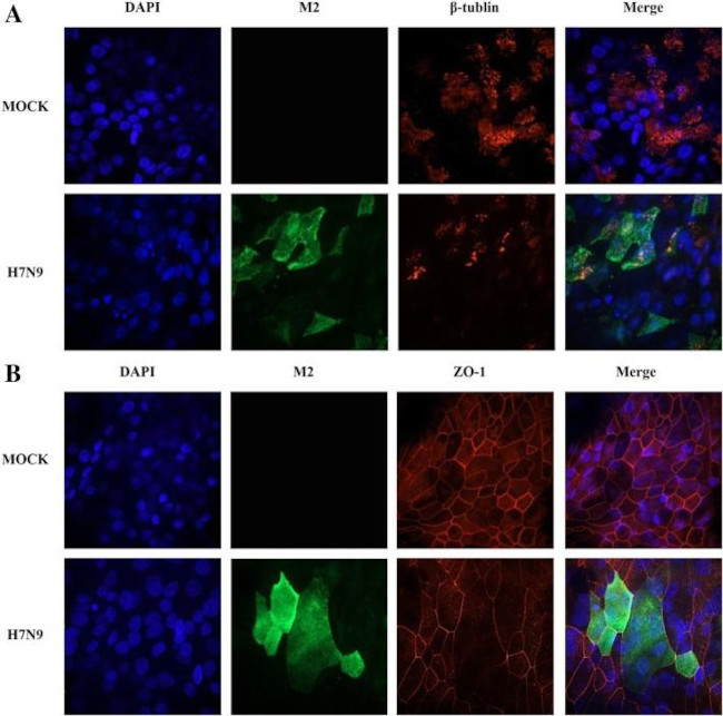 Influenza A M2 Antibody in Immunocytochemistry (ICC/IF)