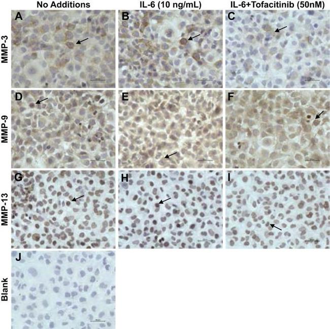 MMP9 Antibody in Immunocytochemistry (ICC/IF)