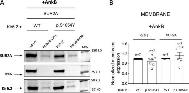 SUR2A Antibody in Western Blot (WB)