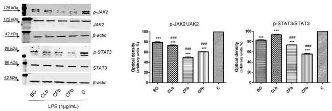 JAK2 Antibody in Western Blot (WB)