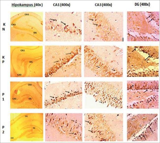 p16INK4a Antibody in Immunohistochemistry (Paraffin) (IHC (P))