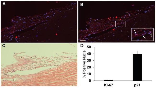 p21 Antibody in Immunohistochemistry (Paraffin) (IHC (P))