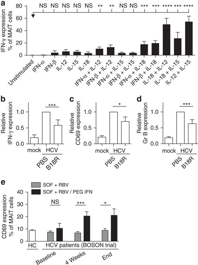 IFN gamma Antibody in Neutralization (Neu)