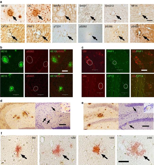 Phospho-Tau (Ser422) Antibody in Immunohistochemistry (Paraffin) (IHC (P))