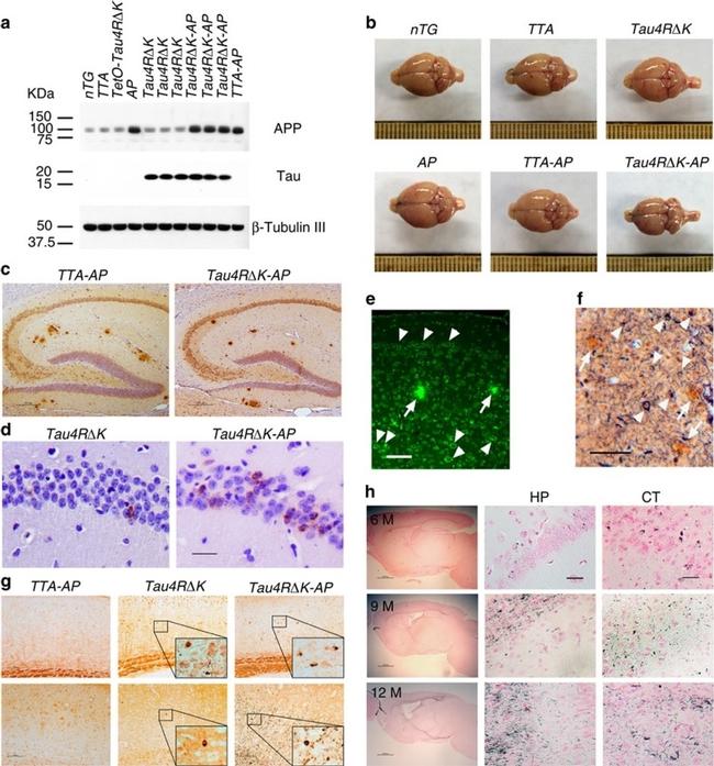 Phospho-Tau (Ser422) Antibody in Immunohistochemistry (Paraffin) (IHC (P))