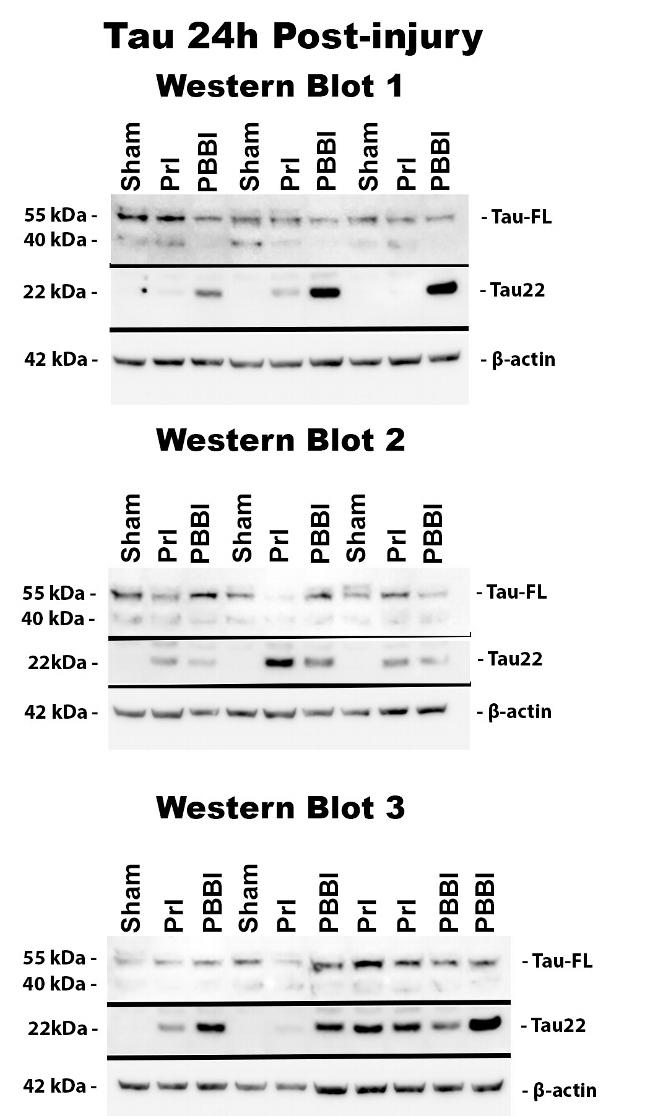 Tau (Cleaved Asp421, Asp422) Antibody in Western Blot (WB)