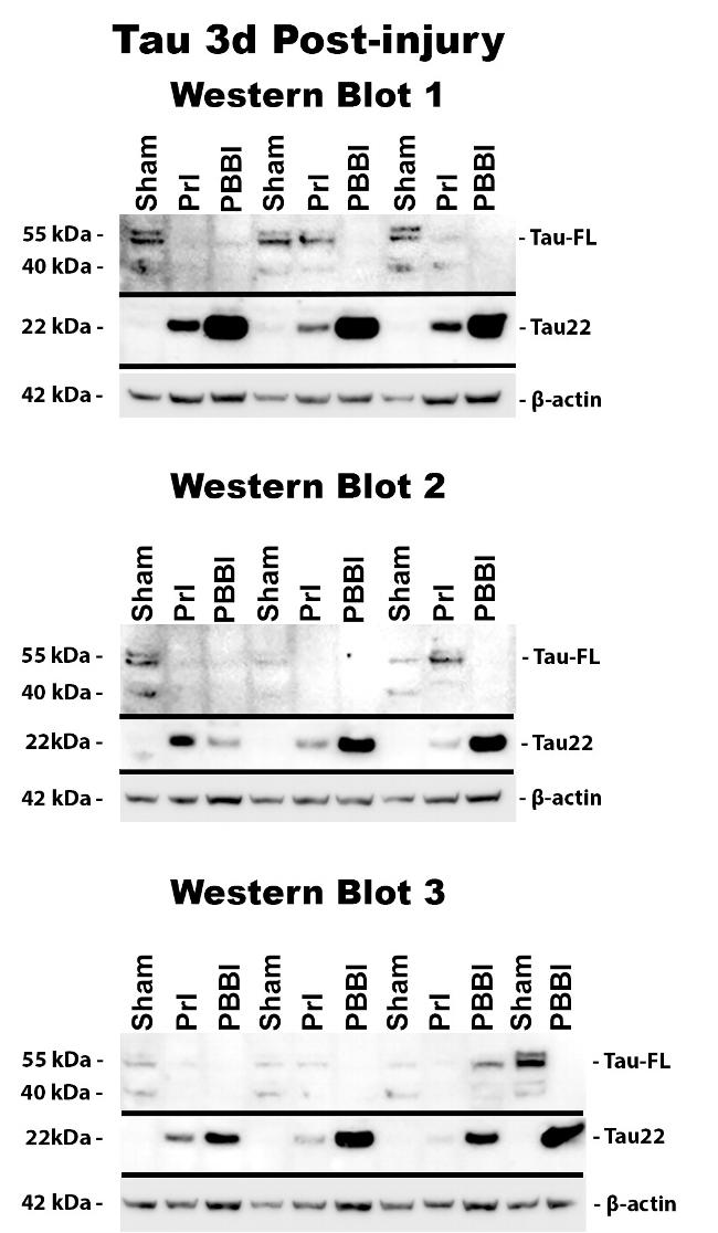 Tau (Cleaved Asp421, Asp422) Antibody in Western Blot (WB)