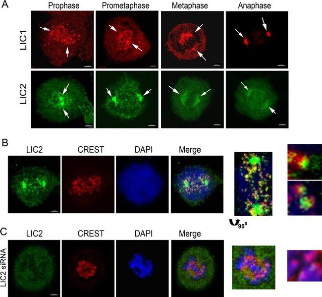 DYNC1LI2 Antibody in Immunocytochemistry (ICC/IF)