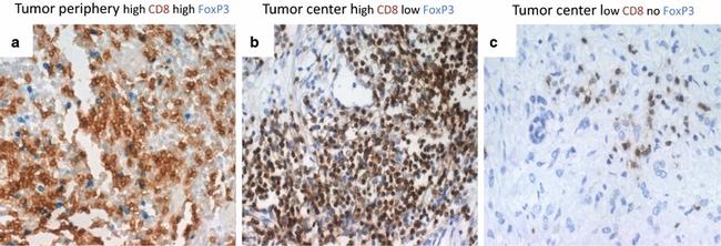 FOXP3 Antibody in Immunohistochemistry (Frozen) (IHC (F))