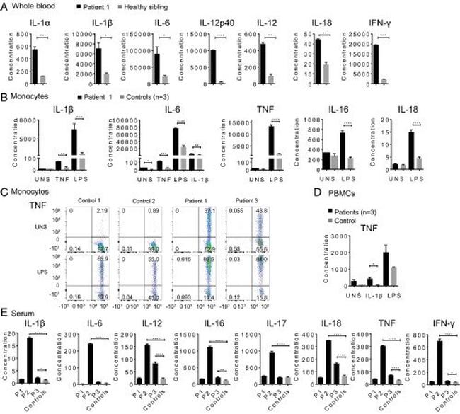 IL-6 Antibody in ELISA (ELISA)