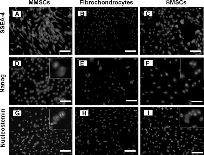 SSEA4 Antibody in Immunohistochemistry (IHC)