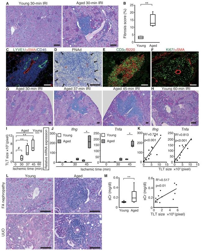 CD45 Antibody in Immunocytochemistry, Immunohistochemistry (Paraffin) (ICC/IF, IHC (P))