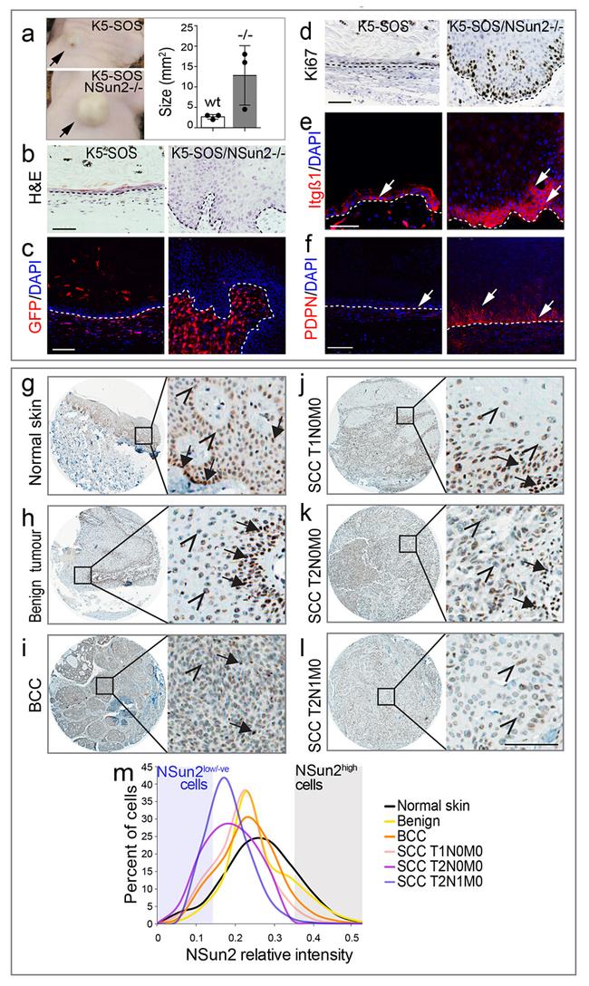 Podoplanin Antibody in Immunohistochemistry (IHC)