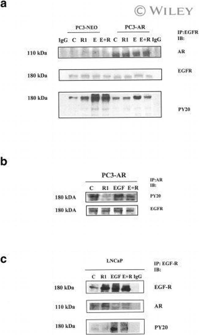 Androgen Receptor Antibody in Immunoprecipitation (IP)