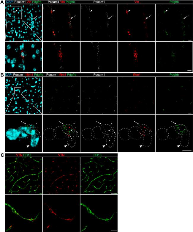 CD140b (PDGFRB) Antibody in Immunohistochemistry (IHC)