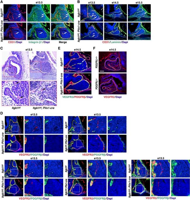 CD140b (PDGFRB) Antibody in Immunohistochemistry (IHC)