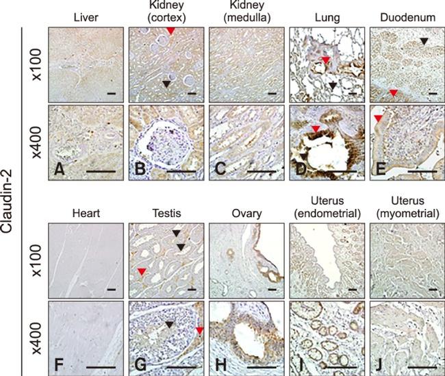 Claudin 2 Antibody in Immunohistochemistry (IHC)