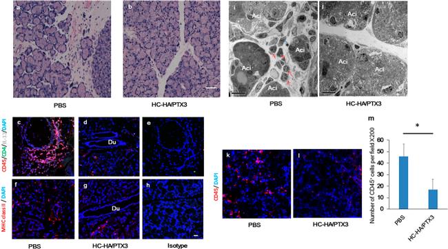 CD45 Antibody in Immunohistochemistry (IHC)